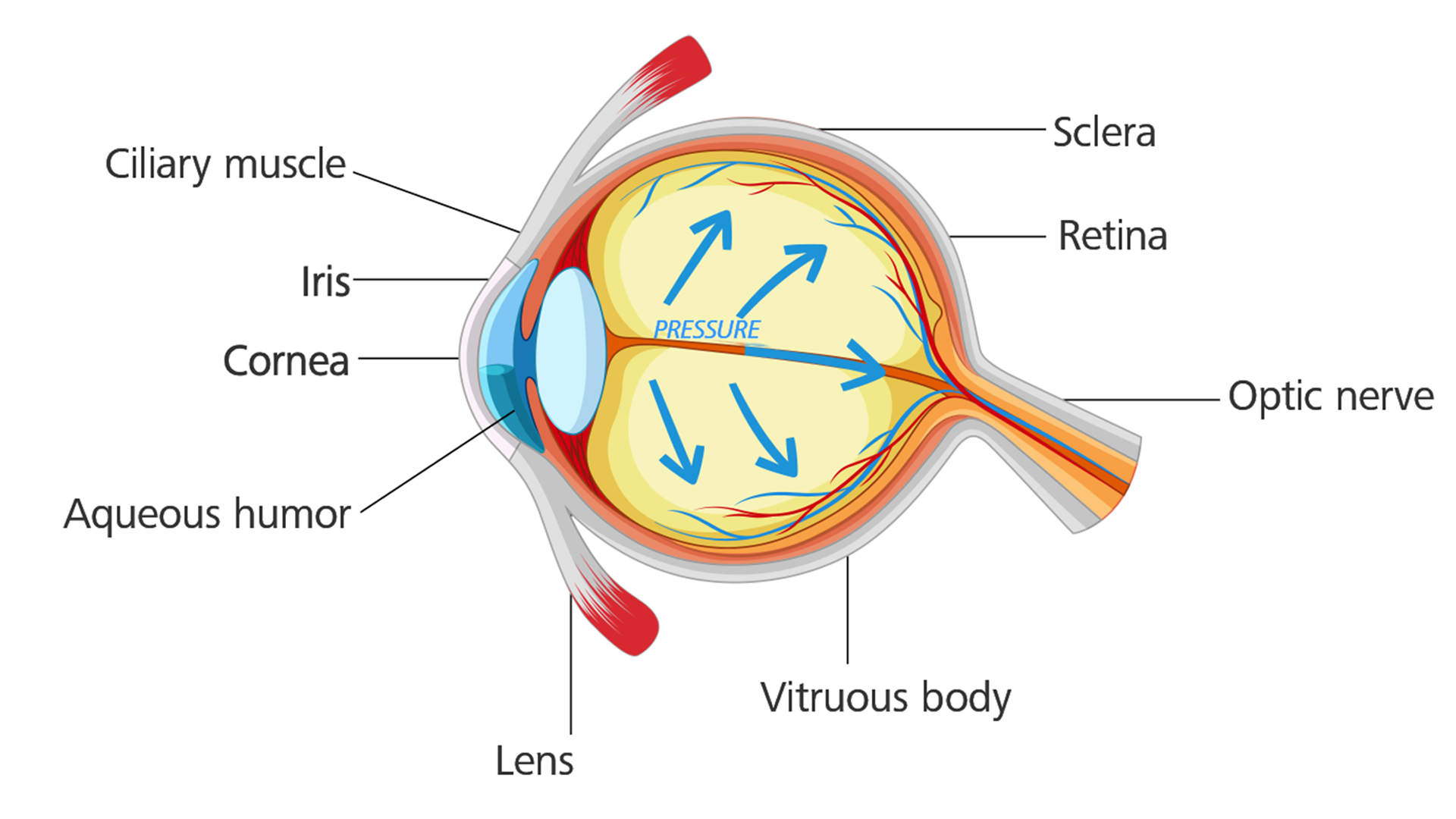 Glaucoma - High Internal Eye Pressure That Causes Vision Loss